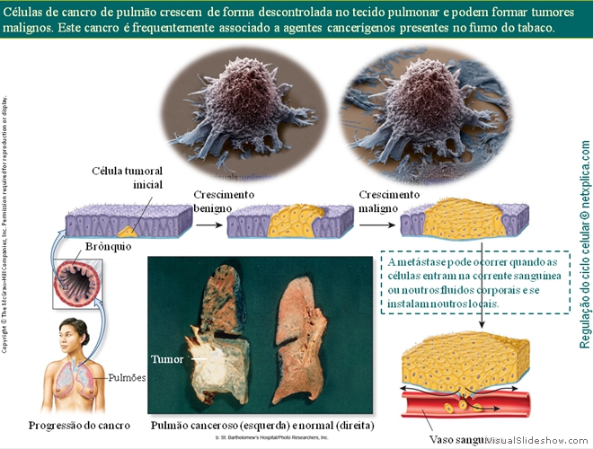 Diapositivo93