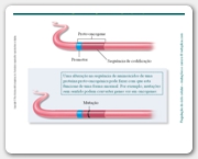 Diapositivo35