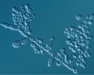 candidiasis oral