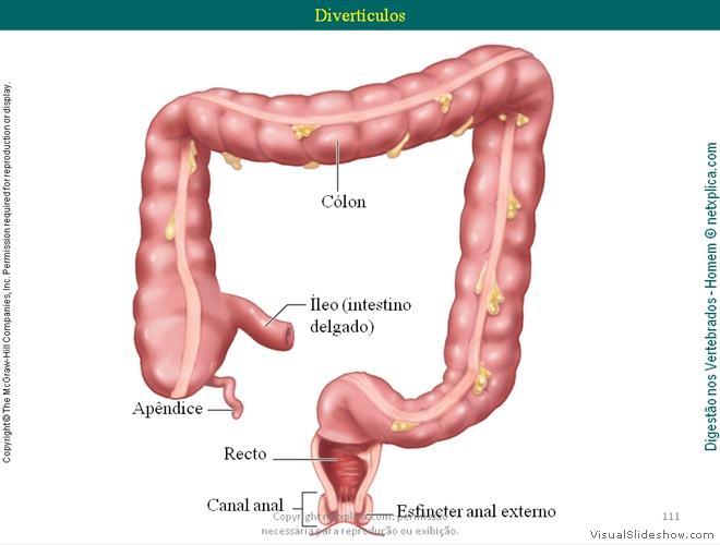 Diapositivo111