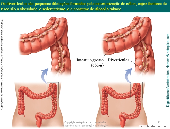 Diapositivo112