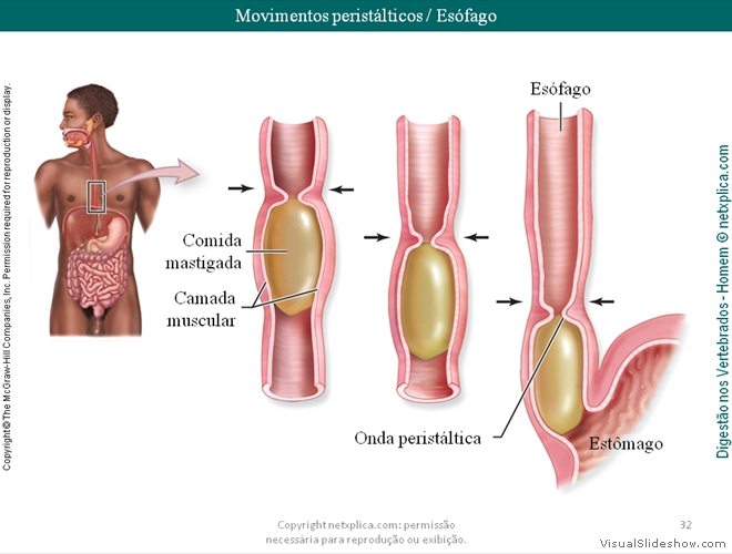 Diapositivo32