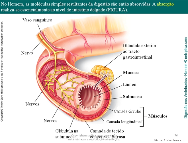 Diapositivo76