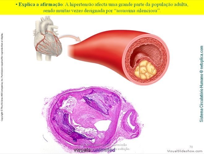 Diapositivo70