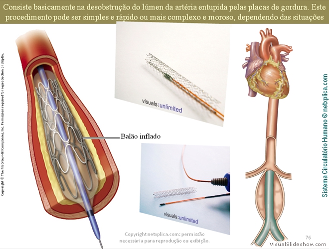 Diapositivo76