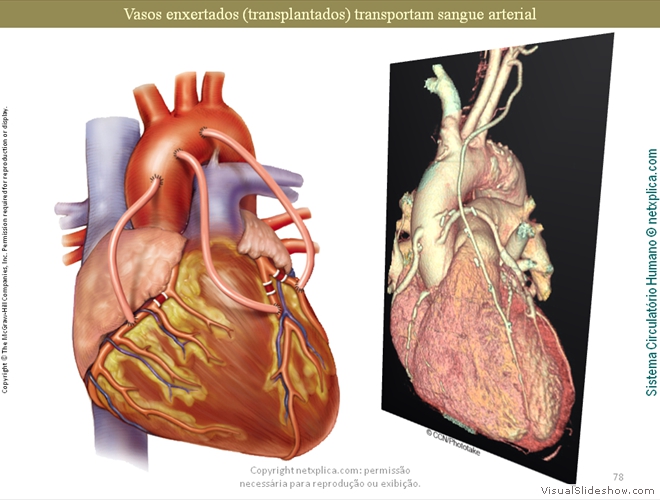 Diapositivo78