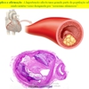 Diapositivo70