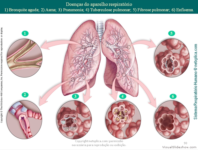 Diapositivo90