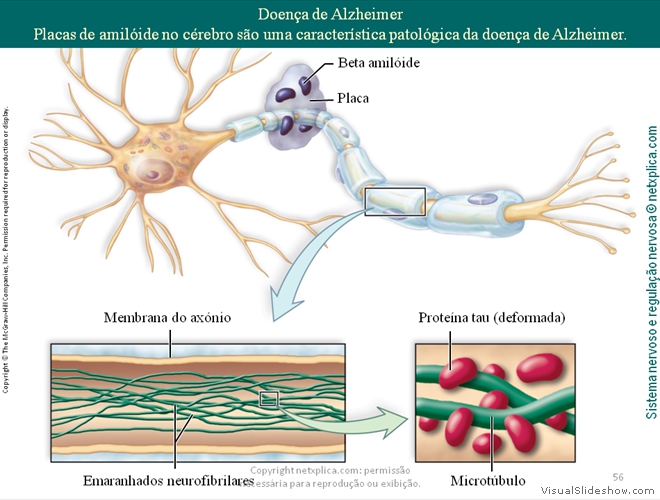 Diapositivo56