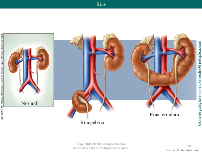Diapositivo19
