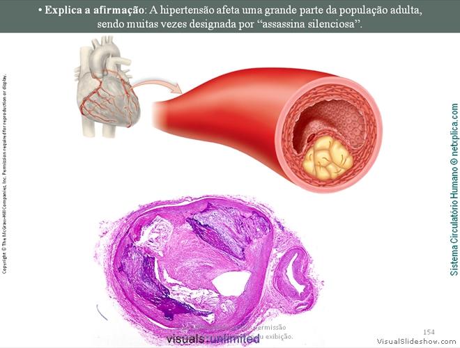 Diapositivo154