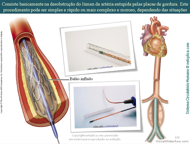 Diapositivo160