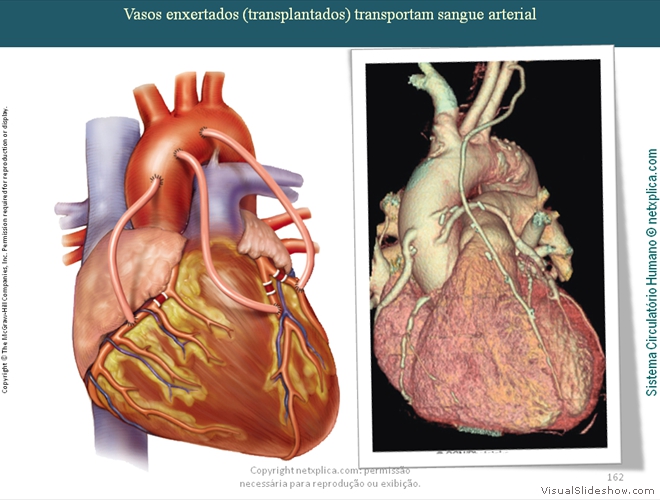 Diapositivo162