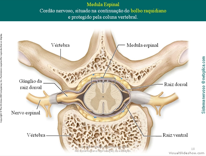 Diapositivo18