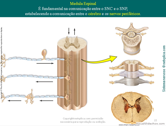 Diapositivo22