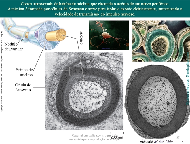 Diapositivo37