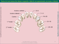 Diapositivo25