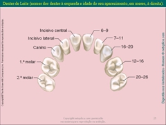 Diapositivo25