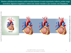 Diapositivo95