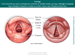 Diapositivo15