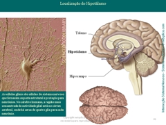 Diapositivo81