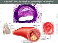 Diapositivo155