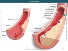 Diapositivo157