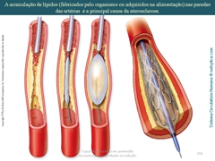 Diapositivo158