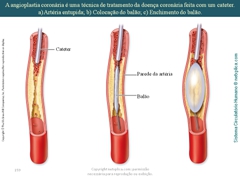 Diapositivo159