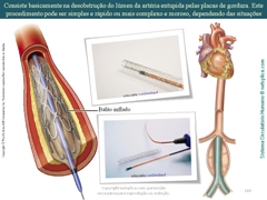 Diapositivo160