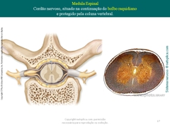 Diapositivo17