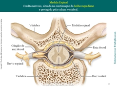 Diapositivo18