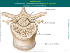 Diapositivo19